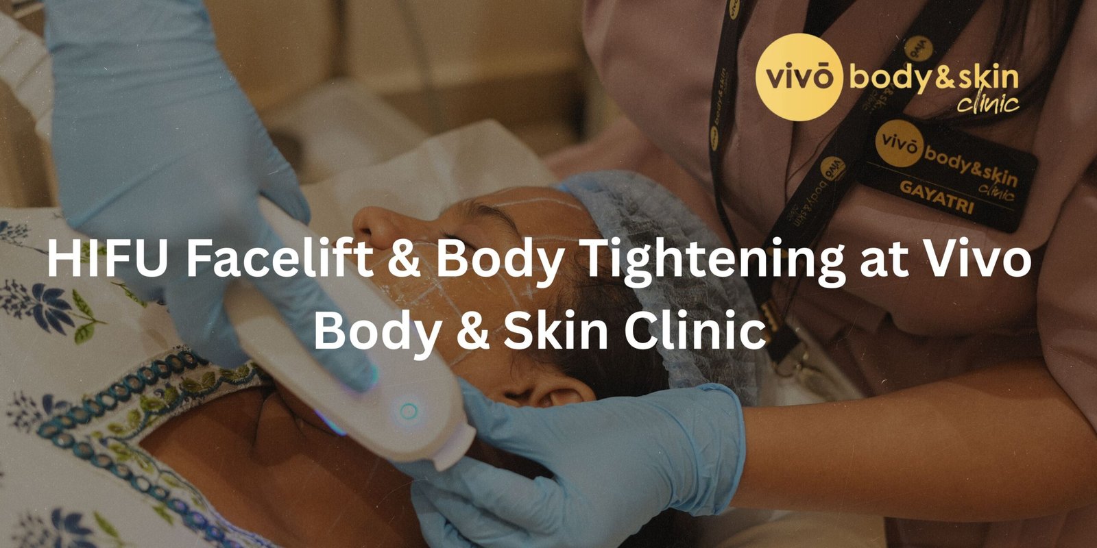 HIFU Facelift Treatment Areas: Face, Jawline, Neck & Body Comparison