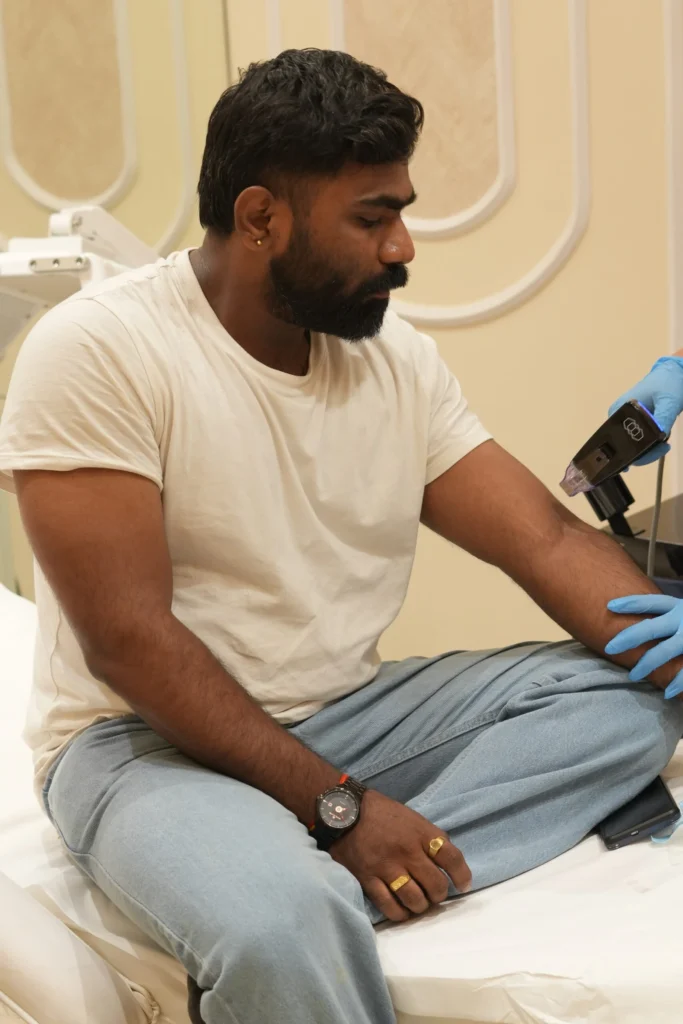 A client undergoing Morpheus8 skin rejuvenation treatment on the arm at Vivo Body & Skin Clinic in Mumbai, targeting both face and body for non-invasive contouring and tightening.