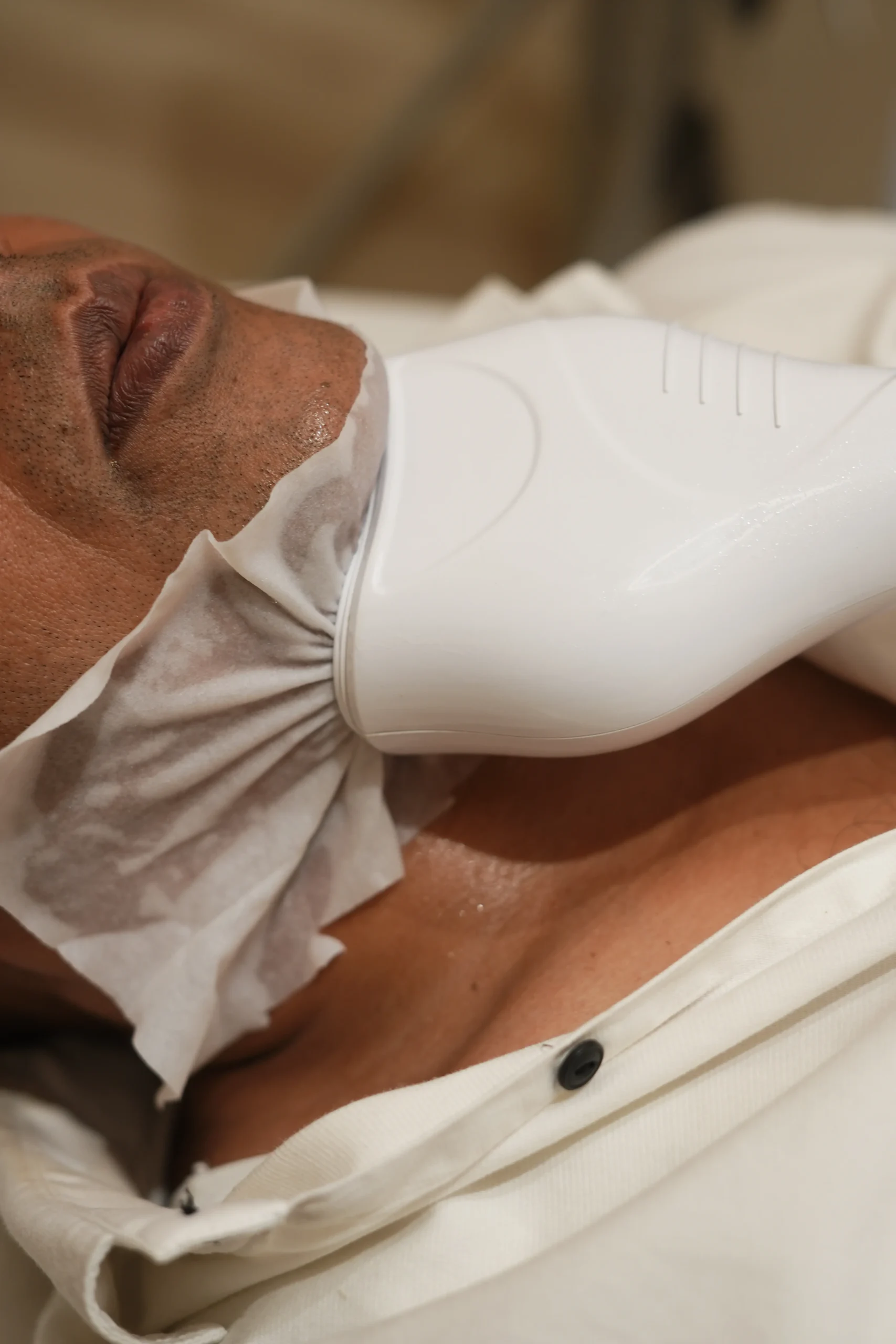 A client undergoing Chin Freeze treatment at Vivo Body & Skin Clinic in Mumbai, targeting stubborn fat in the chin area for a more defined jawline.