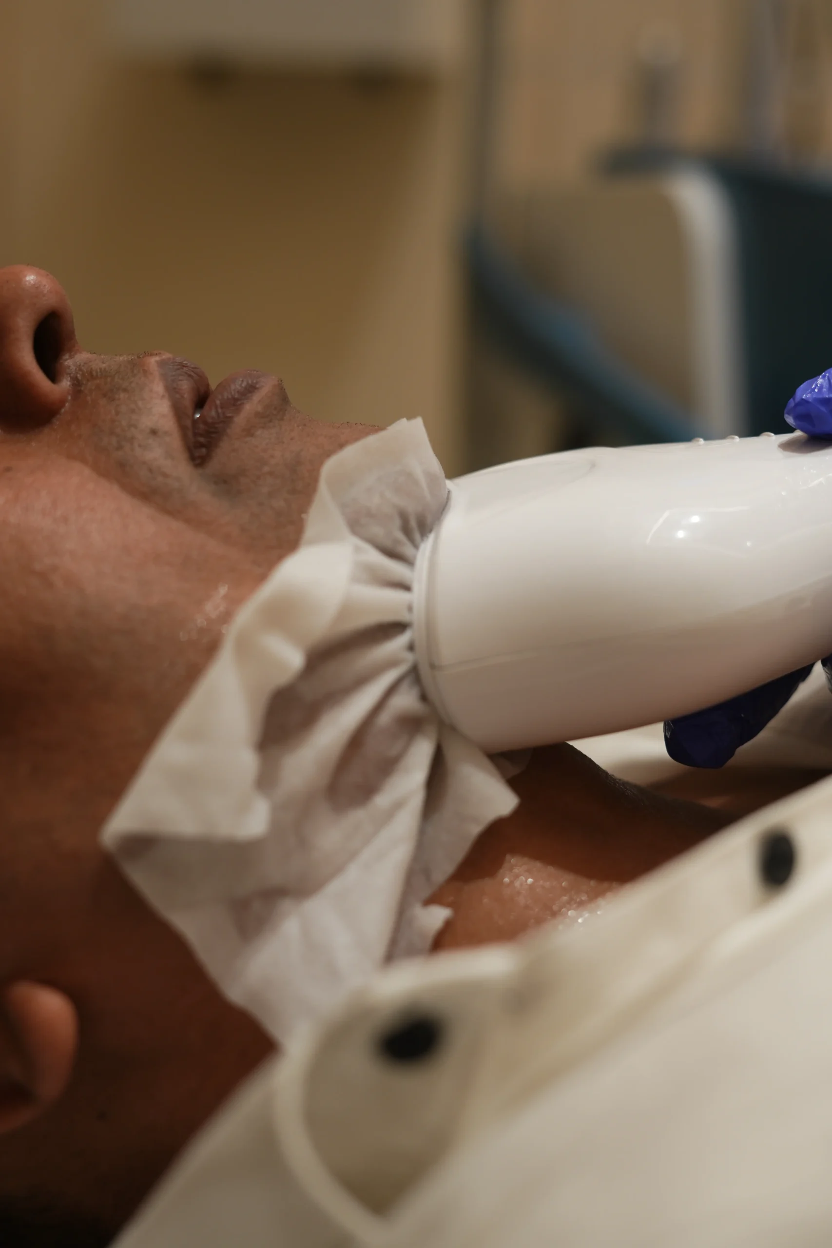 Benefits of Chin Freeze Treatment