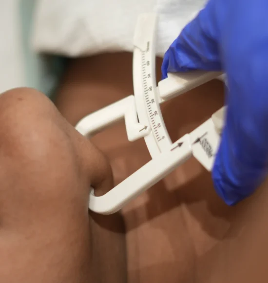 Double Chin Fat reduction