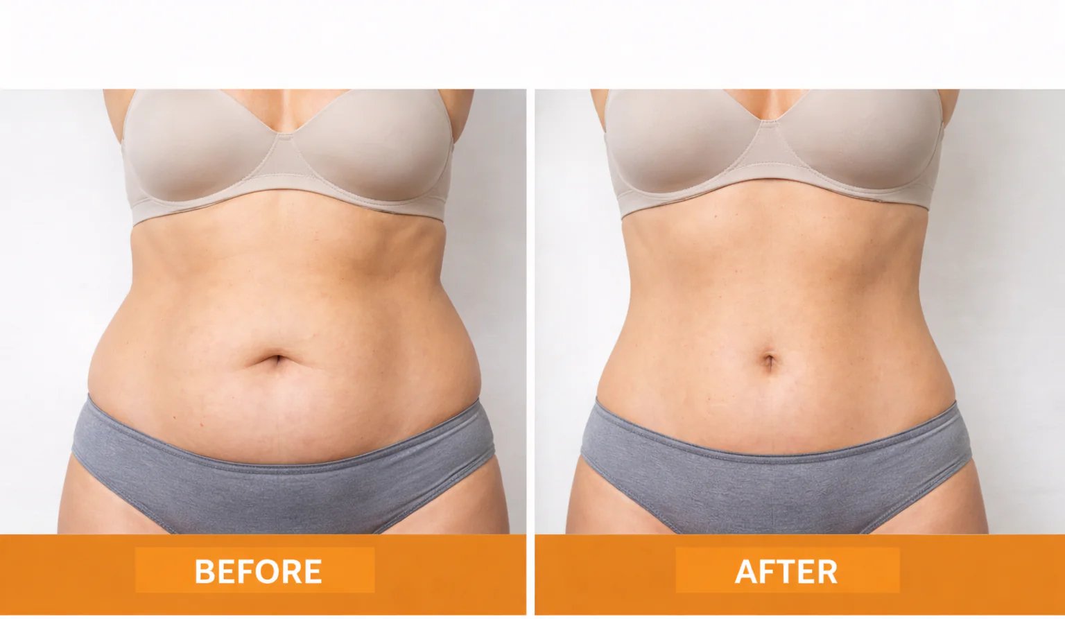 Before and after fat freezing treatment at Vivo Body & Skin Clinic showing improved body contouring on the abdomen."