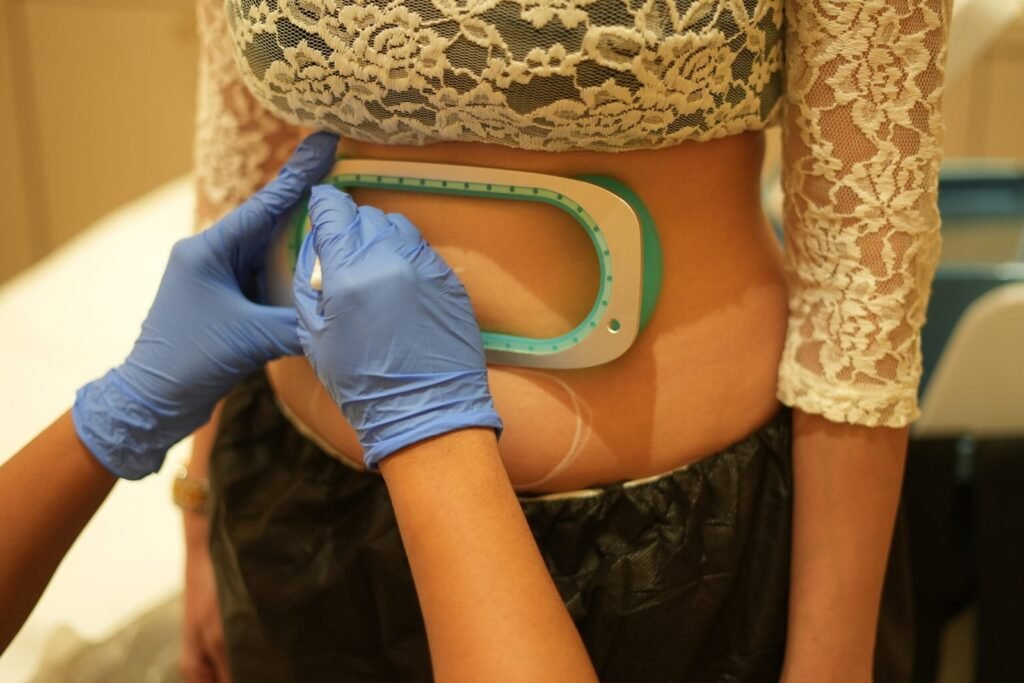 Fat Freezing Cryoliplysis at vivobody and skin clinic mumbai