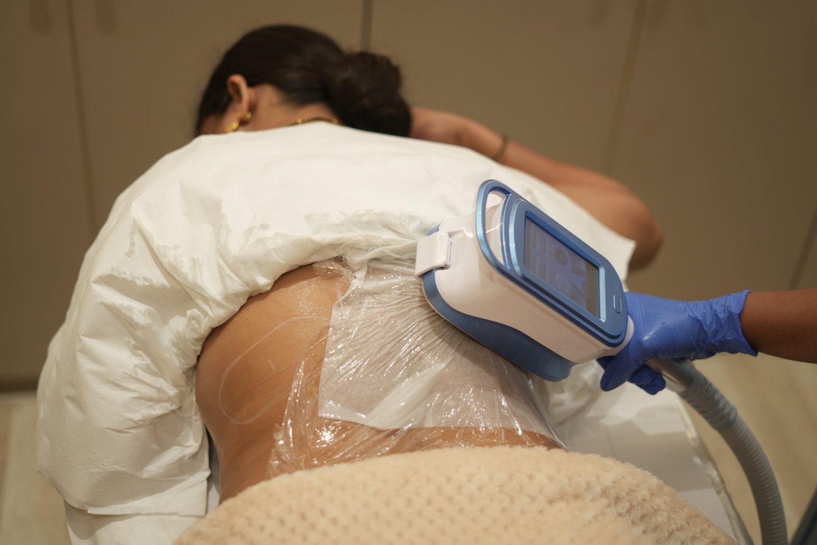 Fat Freezing Treatment in Progress