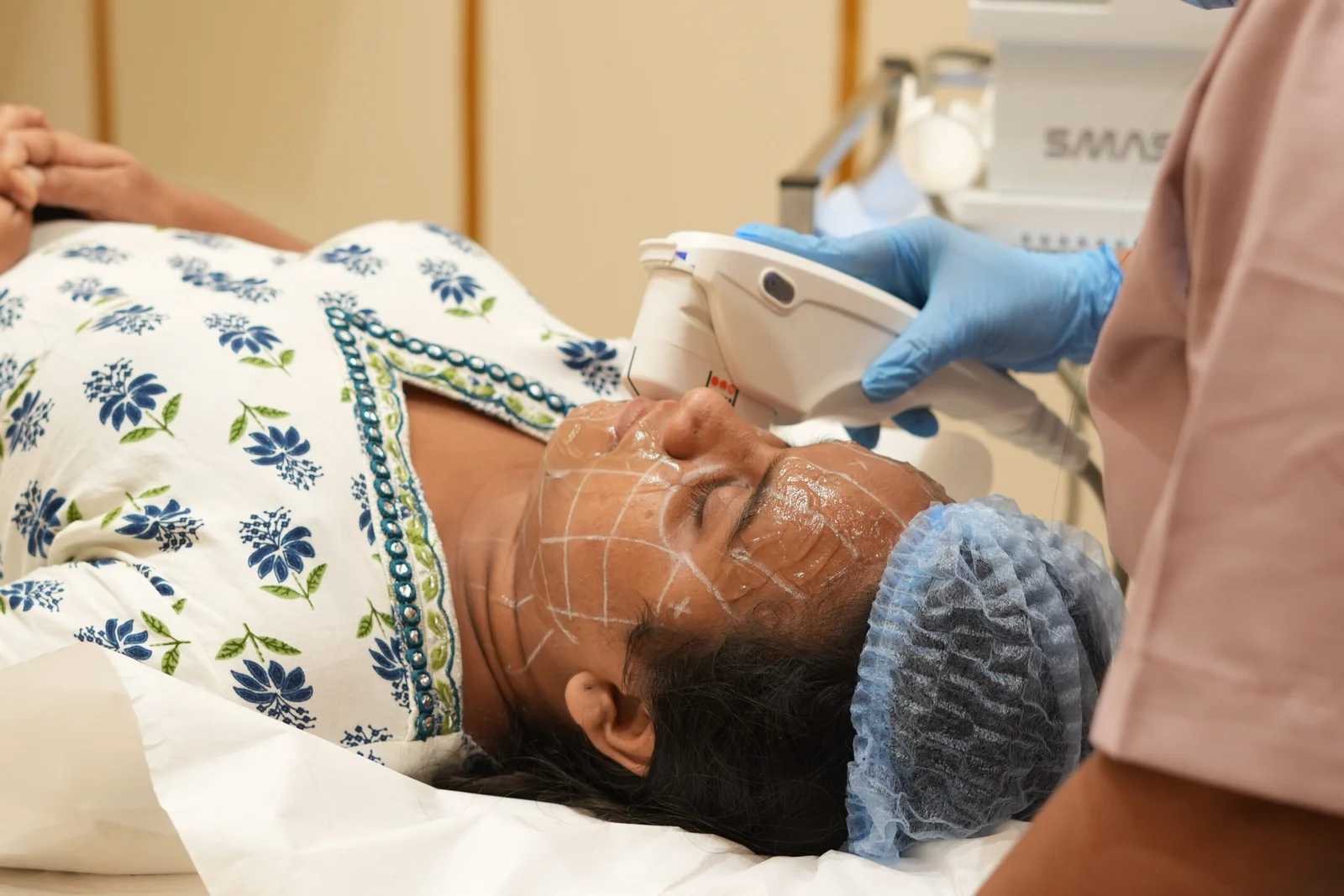 A client undergoing HIFU facial treatment at Vivo Body & Skin Clinic in Mumbai, with the device applied to the face for non-invasive skin tightening and rejuvenation." Let me know if you'd like any adjustments! hifu vaginal Here is the recommended SEO-friendly title and alt text for the HIFU Vaginal Tightening image: Title: "HIFU Vaginal Tightening Treatment at Vivo Body & Skin Clinic, Mumbai" Alt Text: "A calming image symbolizing vaginal rejuvenation with HIFU treatment, offered at Vivo Body & Skin Clinic in Mumbai, enhancing intimate health and restoring confidence." Let me know if you need any changes or further help! Suspicious activity detected