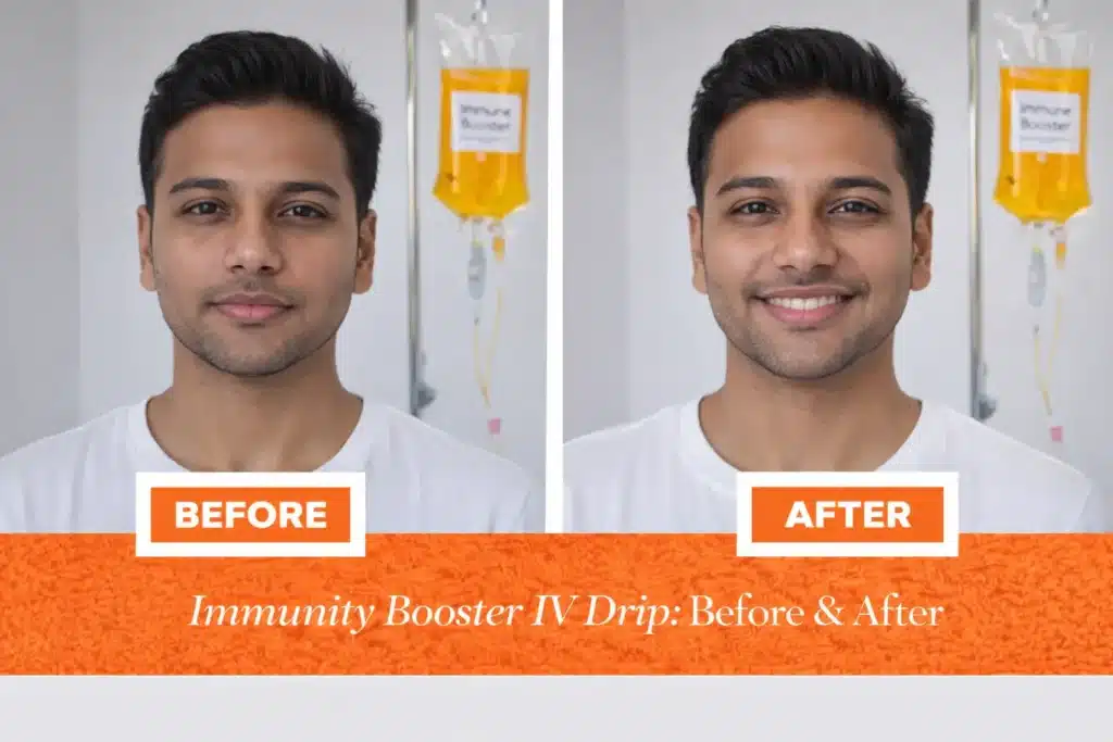 Before and after Immunity Booster IV Drip treatment for Indian male showing enhanced skin tone and revitalized appearance at Vivo Body & Skin Clinic.