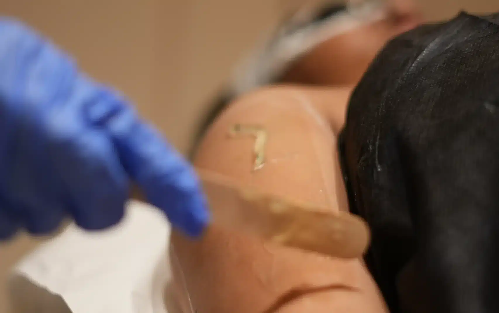 laser hair reduction treatment mumbai vivo body and skin clinic