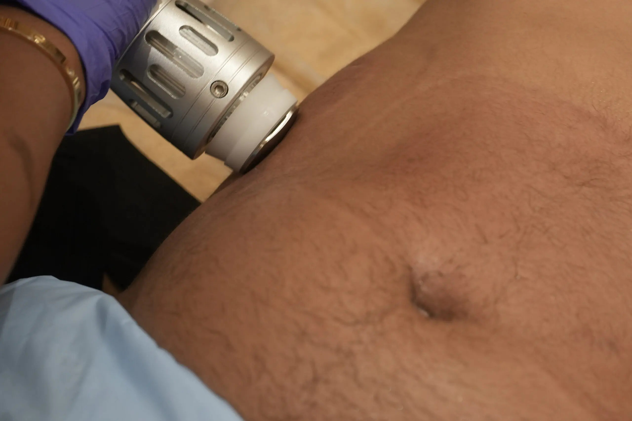 Schockwave at vivobody