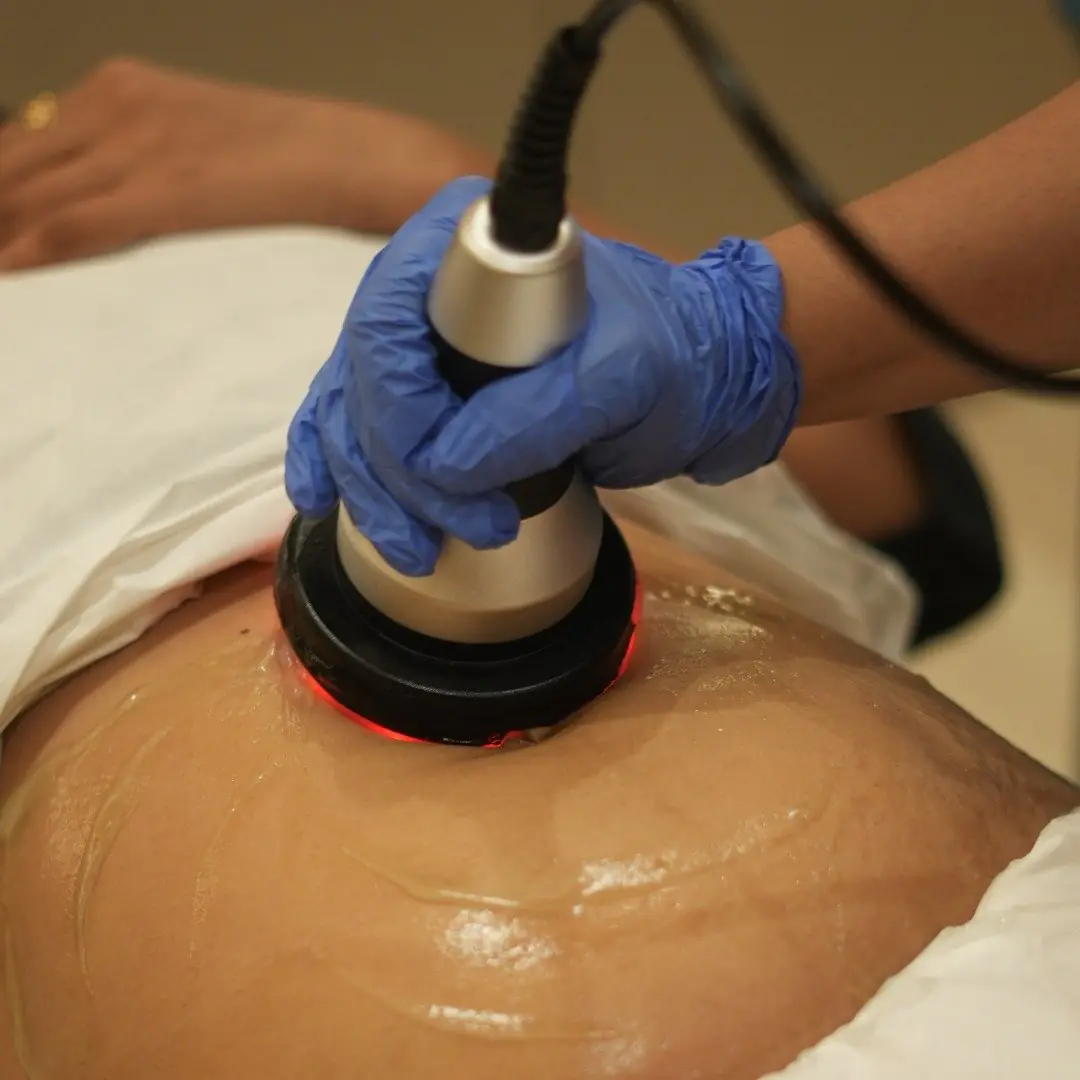 Radiofrequency Body Tightening Treatment machine