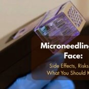 Microneedling for Face