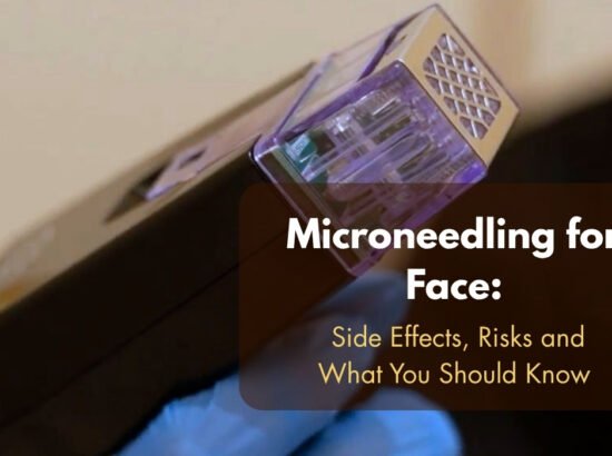 Microneedling for Face: Side Effects, Risks and What You Should Know