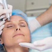 Plasma fibroblast aftercare