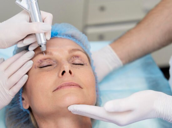 Plasma Eye Lift Recovery Timeline: Day-by-Day Healing Guide