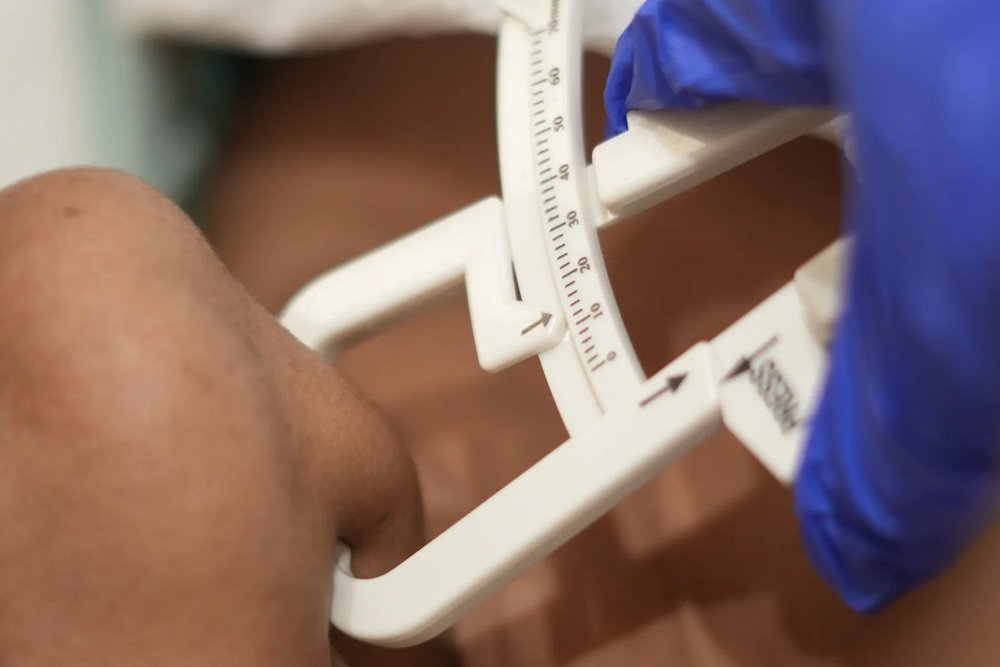 Double Chin Reduction