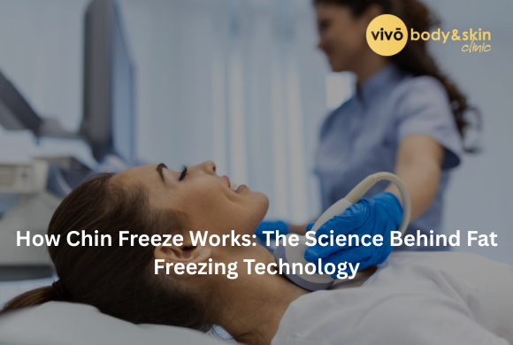 How Chin Freeze Works: The Science Behind Fat Freezing Technology