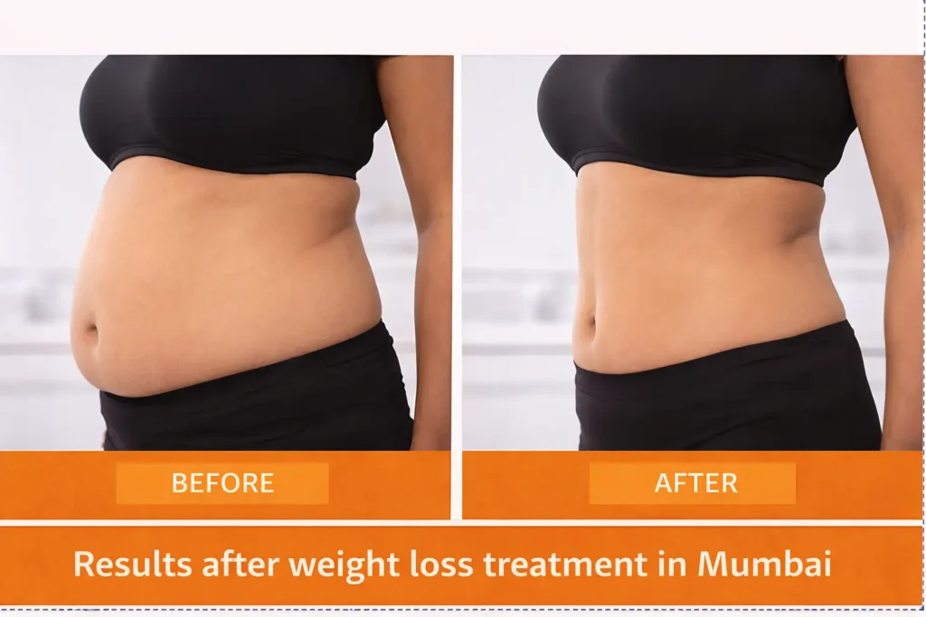 Weight loss progress after treatment