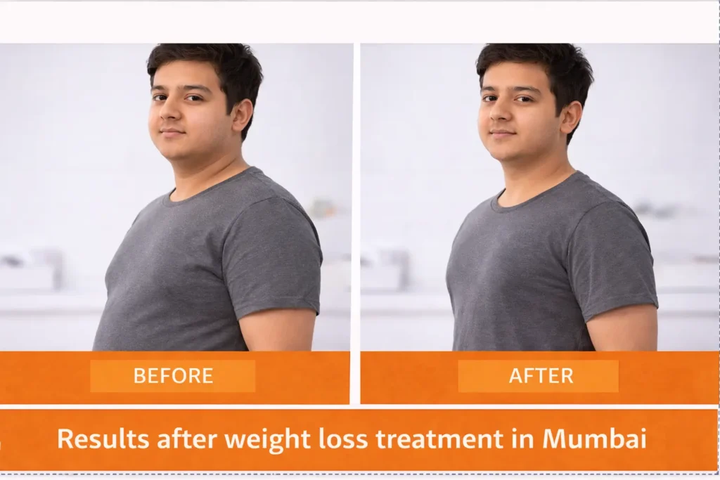 Weight loss transformation in Mumbai