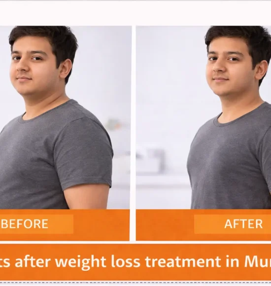 Before & after weight loss