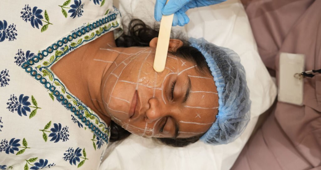 HIFU Facelift in India: Benefits, Results, Cost & Side Effects Explained 2 HIFU Facelift in India