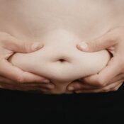 non-surgical treatments for belly fat