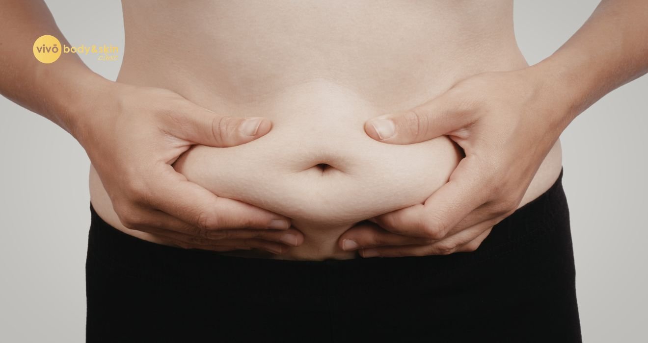 Non‑Surgical Belly Fat Reduction That Works in 2026