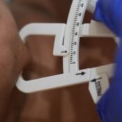 Double Chin Removal Without Surgery