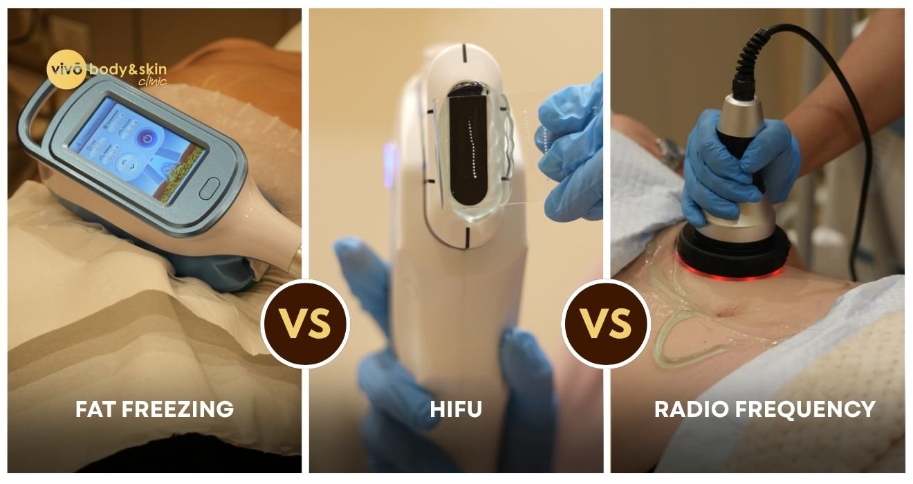 Fat Freezing vs HIFU vs RF for Body Contouring