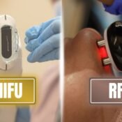 HIFU vs RF Skin Tightening