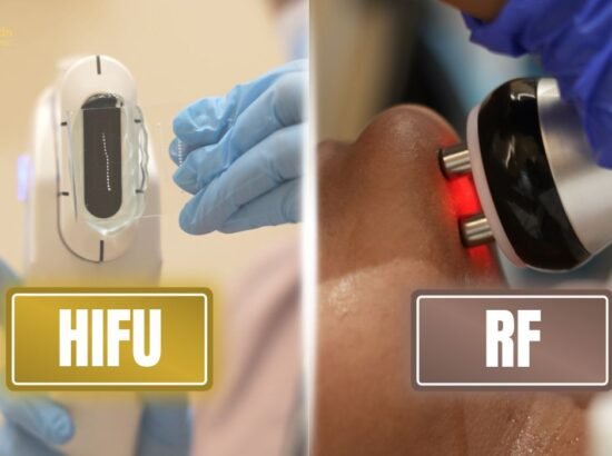 HIFU vs RF Skin Tightening: Which Is Right for You?