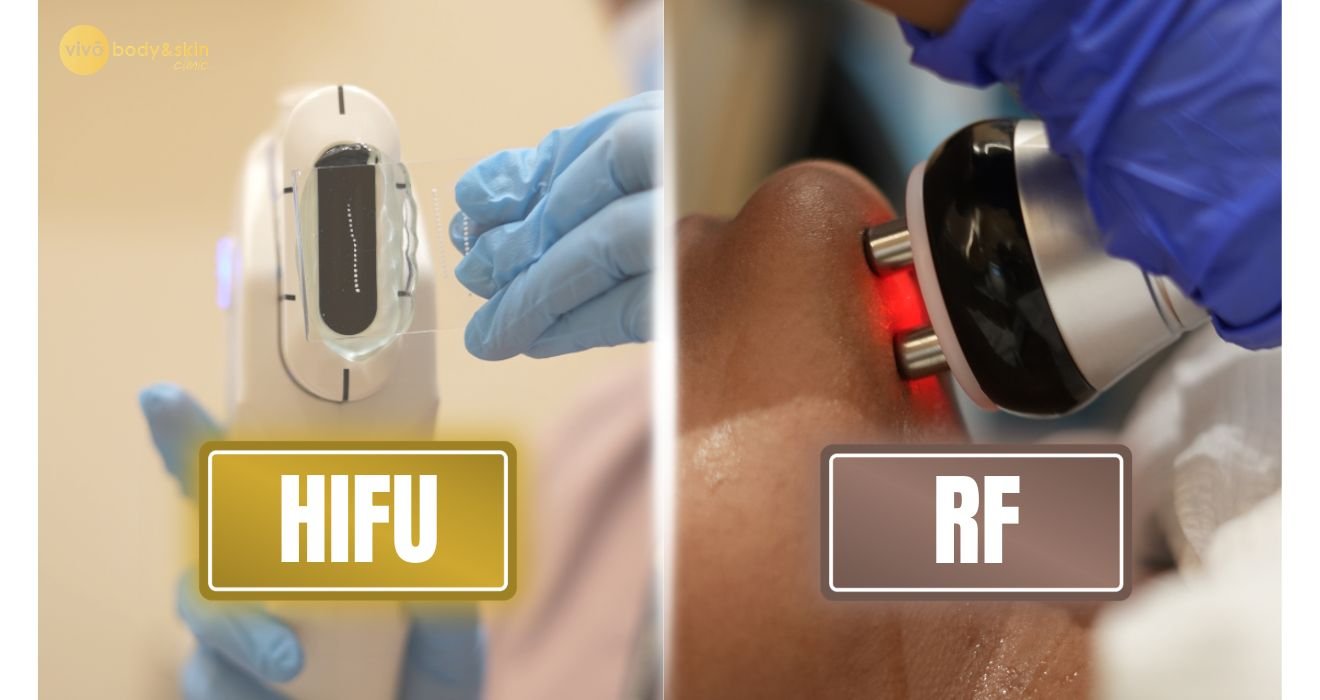HIFU vs RF Skin Tightening: Which Is Right for You?