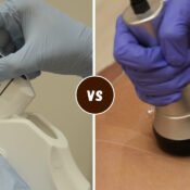 HIFU vs Ultrasound Cavitation for body contouring