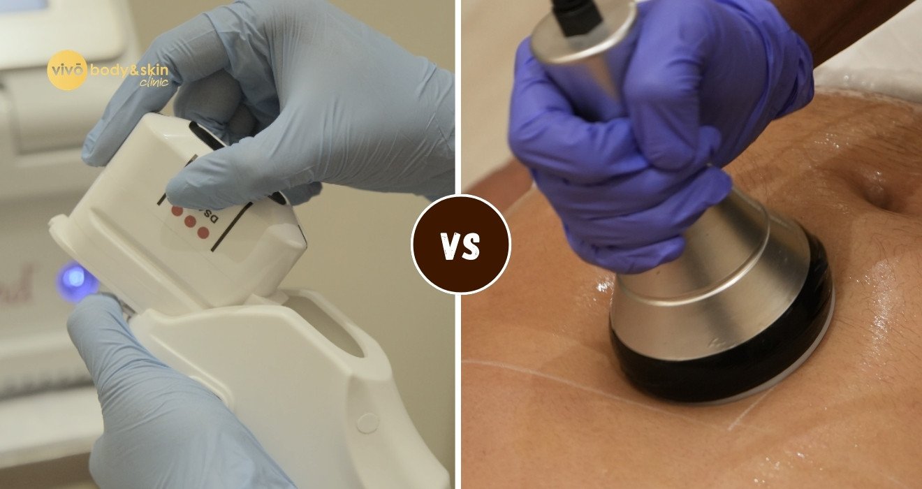 HIFU vs Ultrasound Cavitation for body contouring