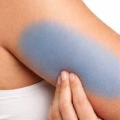 Non-Surgical Arm Fat Reduction in India