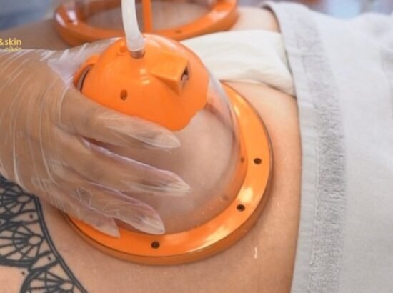 Non-Surgical Butt Lift Options in India: Natural Lift 2026 1 Non-Surgical Butt Lift Options in India: Natural Lift 2026