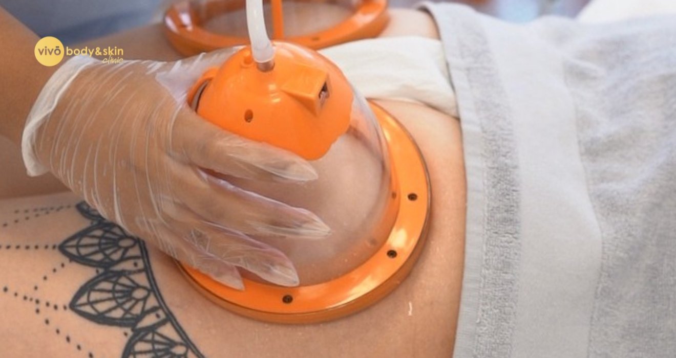 Non-Surgical Butt Lift Options in India: Natural Lift 2026 6 Non-Surgical Butt Lift Options in India: Natural Lift 2026