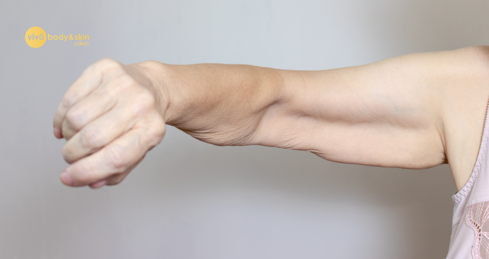 Non-Surgical Arm & Shoulder Lift After Weight Loss in India (2026)