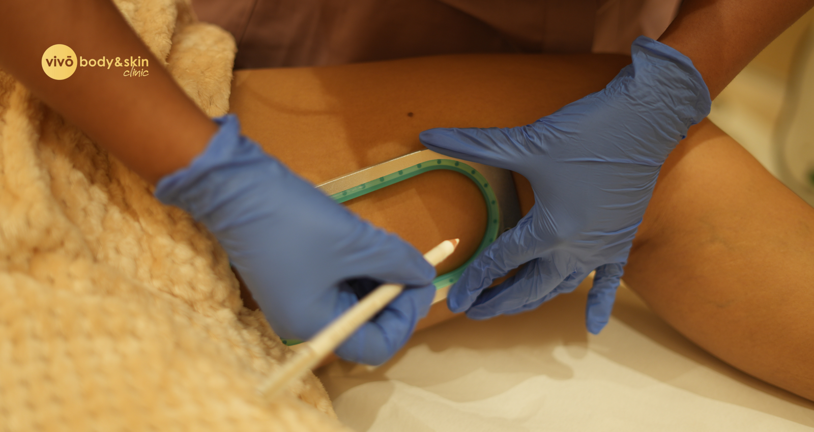 Non-Surgical Knee & Inner Thigh Slimming in India: What Works