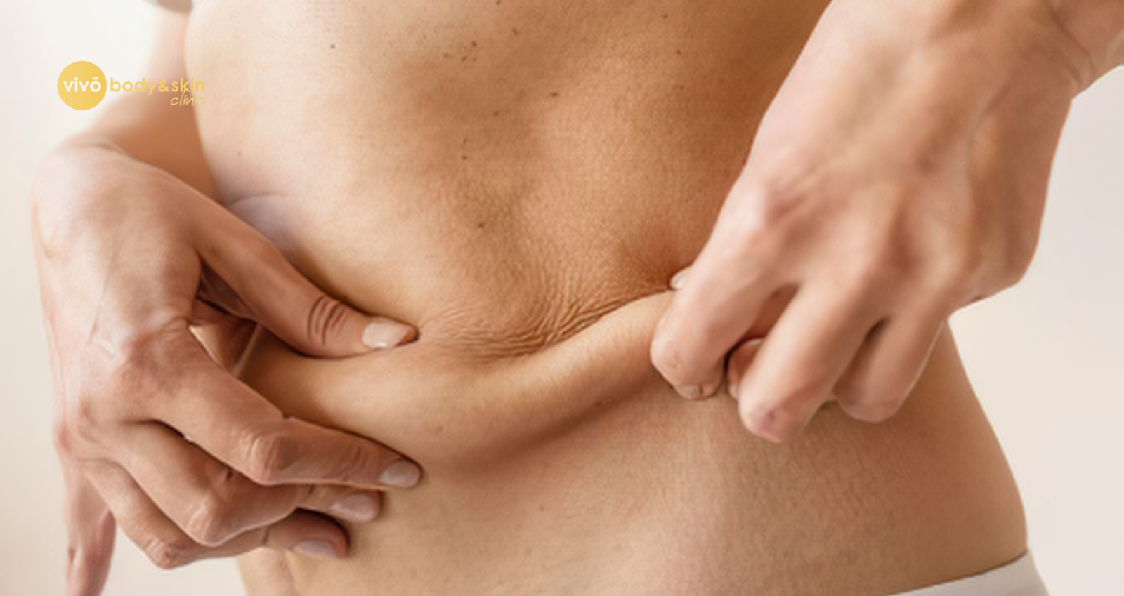 【極美品】Non-Surgical Skin Tightening and Li Non-Surgical Skin Tightening After Weight Loss India