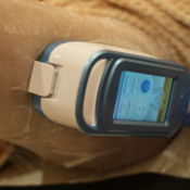 How Many Fat Freezing Sessions Do You Actually Need?