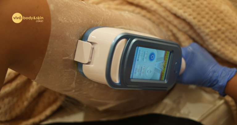 How Many Fat Freezing Sessions Do You Actually Need?