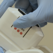 Post-Pregnancy Facial Rejuvenation India: HIFU vs RF vs Microneedling