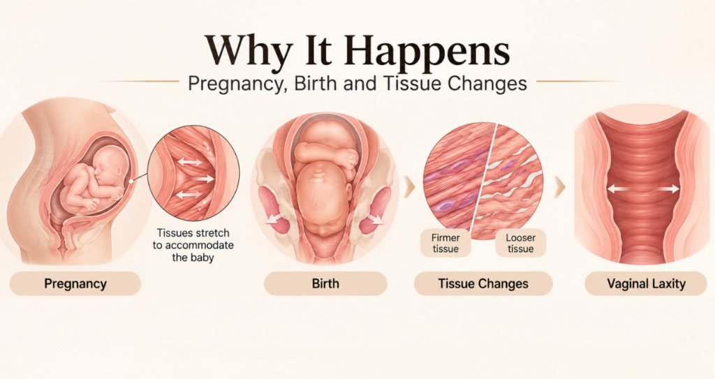Vaginal Laxity After Childbirth: Causes & Treatment Options 3 Why It Happens Pregnancy Birth and Tissue Changes